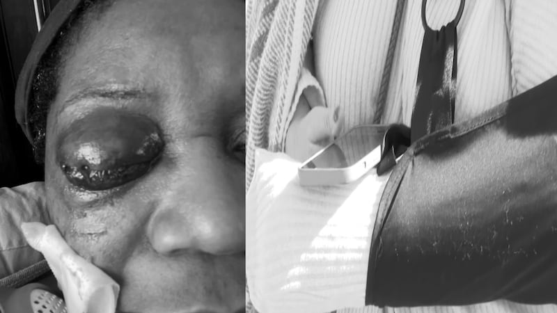 Educators examine intervention training processes after two educators were hurt by students at...