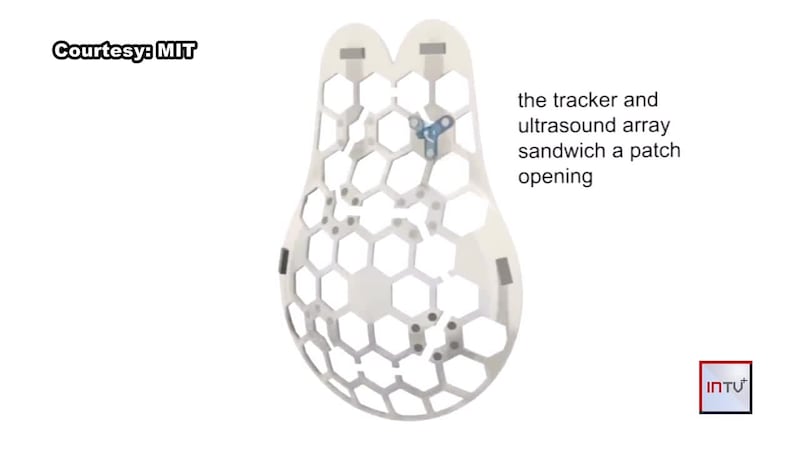 New technology helping to support many battling breast cancer