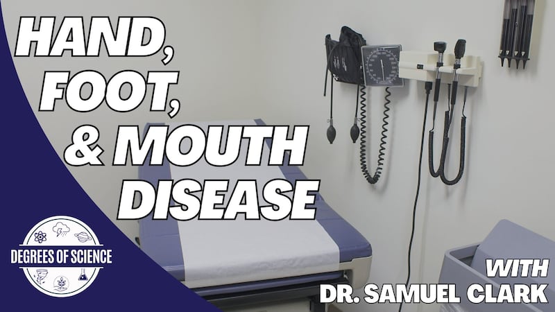 Degrees of Science: Hand, Foot, & Mouth Disease